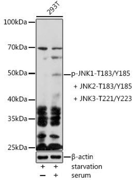 Anti-Phospho-JNK1-T183/Y185 + JNK2-T183/Y185 + JNK3-T221/Y223 Antibody (CABP1163)