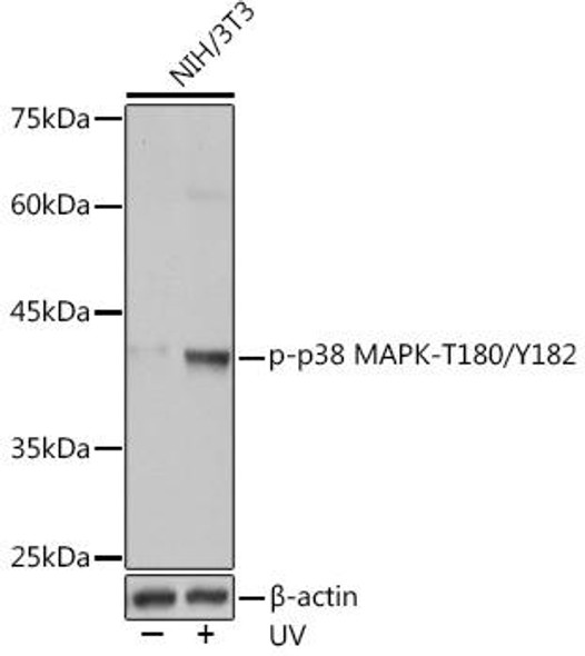 Anti-Phospho-p38 MAPK-T180/Y182 Antibody (CABP1165)