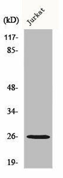 GJB2 Antibody (PACO00626)