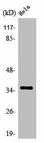 OR52N4 Antibody (PACO01245)