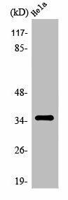 OR6K2 Antibody (PACO01256)