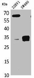 SFTPA2 Antibody (PACO01904)