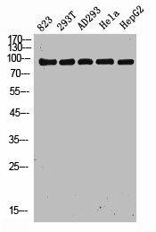 DDIAS Antibody (PACO02229)