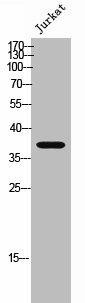 RRH Antibody (PACO02355)