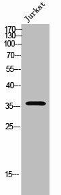 OR52E2 Antibody (PACO02439)