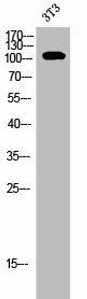 EPHB1/EPHB2/EPHB3/EPHB4 Antibody (PACO02656)