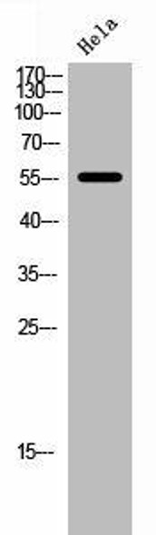 FOXC1/FOXC2 Antibody (PACO02739)