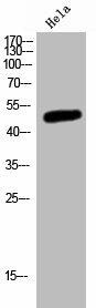 MKNK2 Antibody (PACO02788)