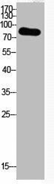 Acetyl-UBA52/RPS27A/UBB/UBC (K29) Antibody (PACO06079)