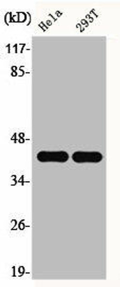 EFNB1/EFNB2 Antibody (PACO06468)