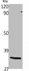 OR1S2/OR1S1 Antibody (PACO06710)