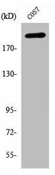 ZNF106 Antibody (PACO06860)