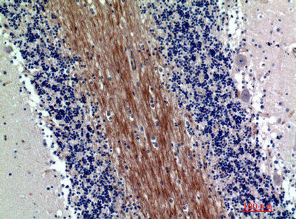 SIRPA/SIRPB1 Antibody (PACO06908)