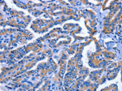 IGSF10 Antibody (PACO14564)