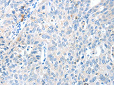 MAGEB4 Antibody (PACO14672)