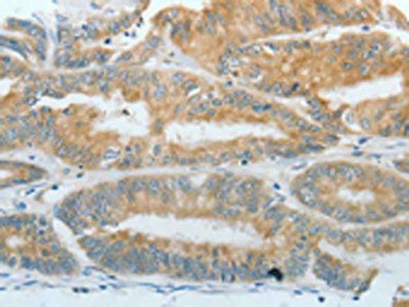 DNAJC3 Antibody (PACO14815)