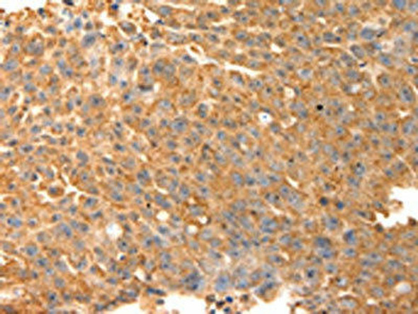 SPATA2L Antibody (PACO15060)