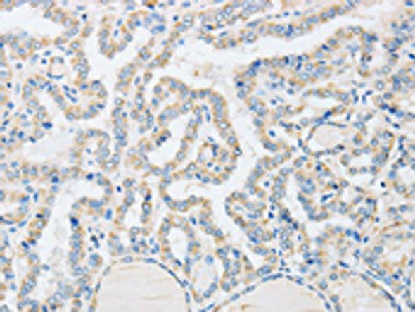 ABHD1 Antibody (PACO15235)