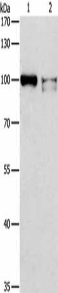 ADAMTSL2 Antibody (PACO15315)