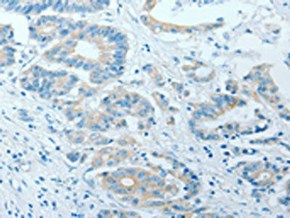AKAP7 Antibody (PACO15357)