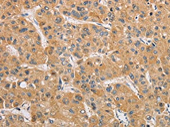 ARSK Antibody (PACO15560)