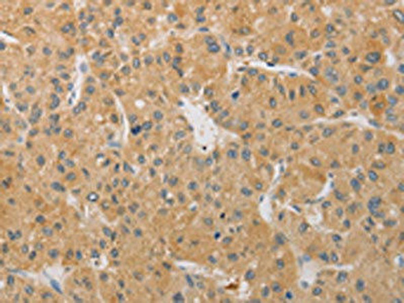 ARSK Antibody (PACO15561)
