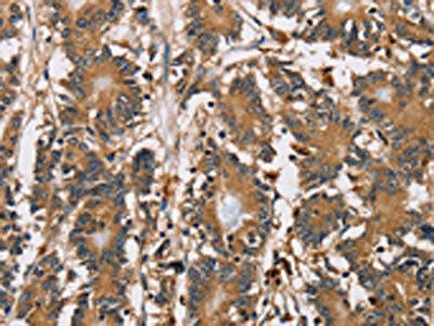 HTR3C Antibody (PACO15798)