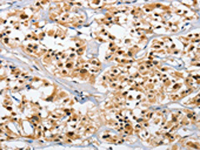 NCAPD3 Antibody (PACO15921)