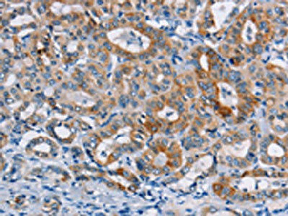 CASC3 Antibody (PACO15934)