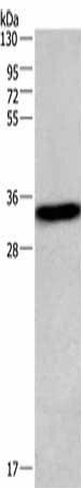 CENPP Antibody (PACO16005)