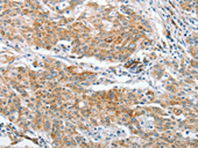 CRELD2 Antibody (PACO16072)