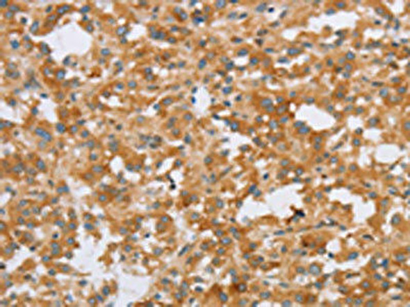 CRELD2 Antibody (PACO16073)