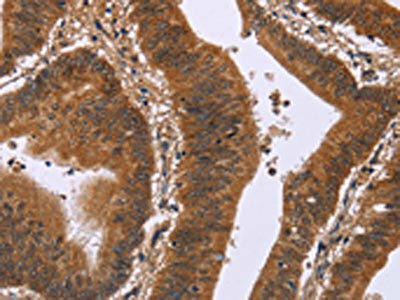 DCBLD2 Antibody (PACO16145)