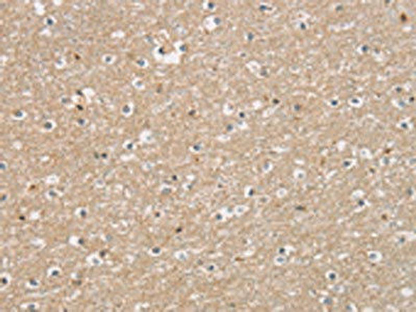 DMRT3 Antibody (PACO16192)