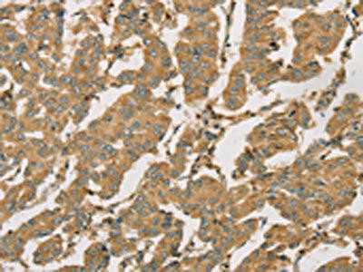 DMRT3 Antibody (PACO16193)