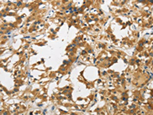 DUSP23 Antibody (PACO16209)