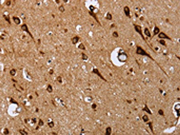 EPDR1 Antibody (PACO16260)