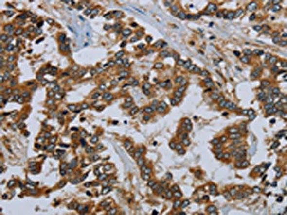 MIER2 Antibody (PACO16689)