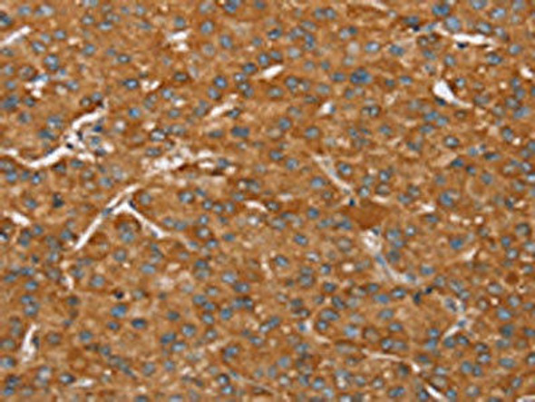PAGE5 Antibody (PACO16827)