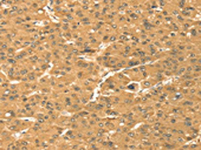 TMEM123 Antibody (PACO16883)