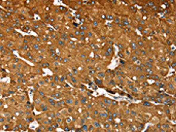 RASSF3 Antibody (PACO16951)