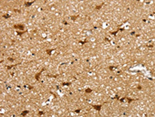 SSBP4 Antibody (PACO17149)