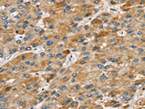 STARD8 Antibody (PACO17162)