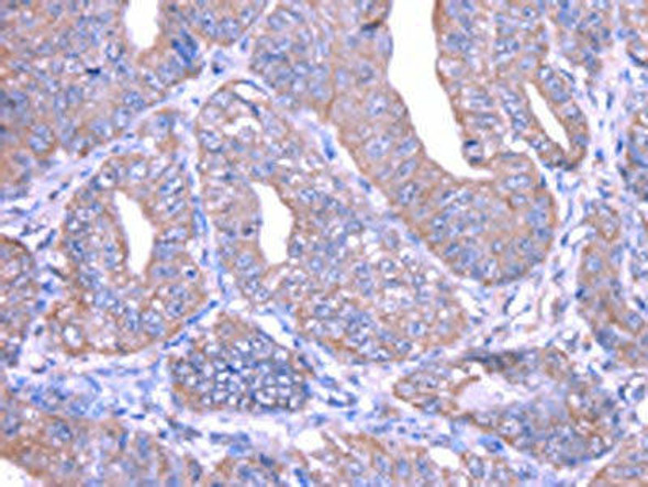 THAP6 Antibody (PACO17232)