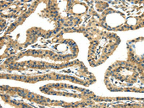 TMPRSS11E Antibody (PACO17280)