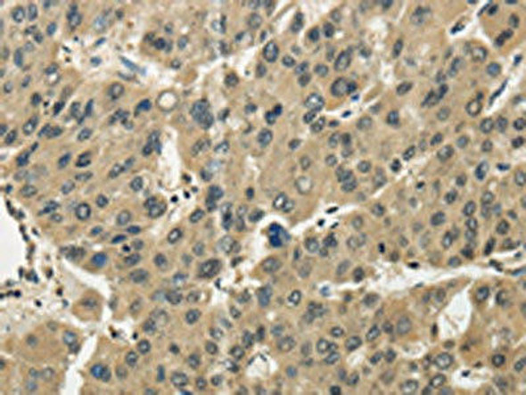 TSSC1 Antibody (PACO17329)