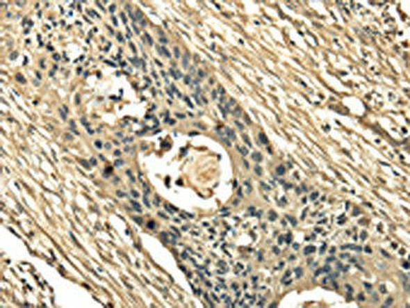 TSSC1 Antibody (PACO17330)