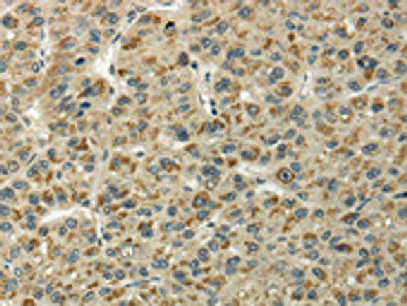 UBL4B Antibody (PACO17357)