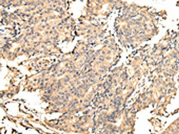 UGGT2 Antibody (PACO17363)