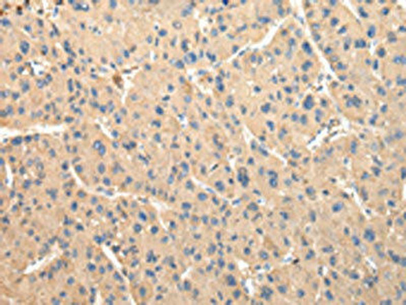 DUSP11 Antibody (PACO17396)